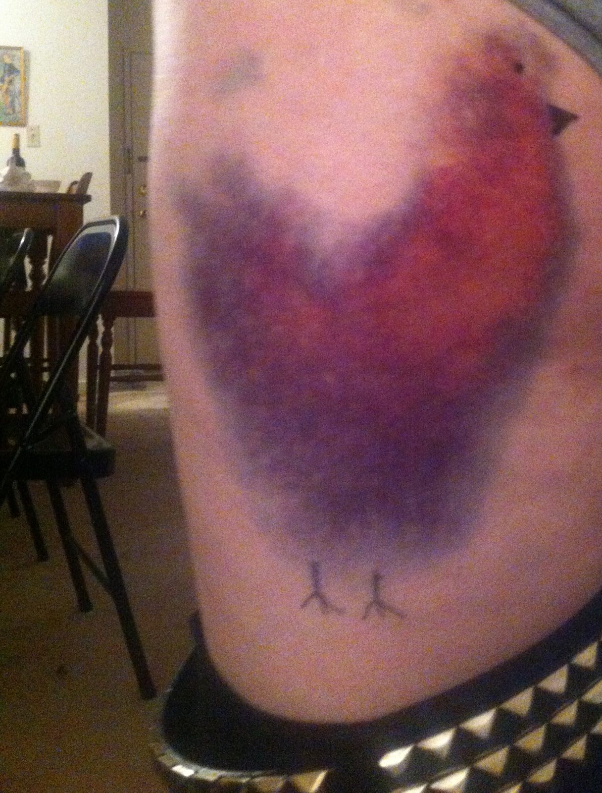 funny-picture-bruise-chicken