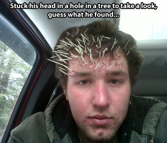 funny-picture-guy-face-porcupine-spines